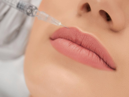How Elegant Are Russian Lip Fillers Designs?