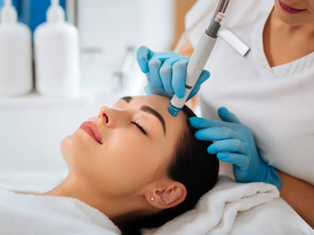 Does Hydrafacial Help Minimize Hyperpigmentation?
