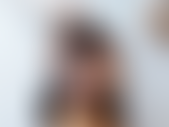 Does Spectra Carbon Peel Enhance Skin Texture?