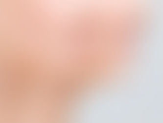 Kybella in Dubai: Non-Surgical Double Chin Reduction