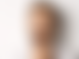 Is Mustache Hair Transplant Suitable for Every Man?