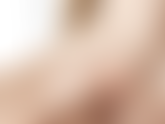 Comparing Laser Scar Removal to Other Scar Treatment Options