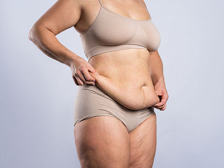 Can a Tummy Tuck Correct an Overhanging Belly Pouch?