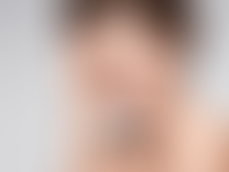 Juvederm Fillers: Your Key to a More Confident You in Dubai