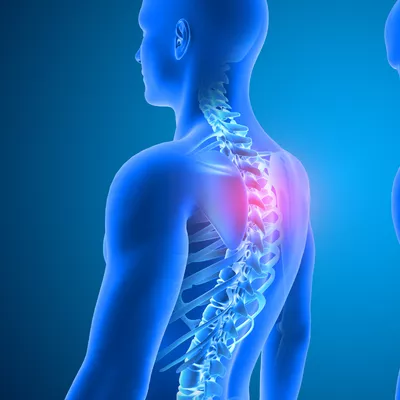 poor posture causes back pain