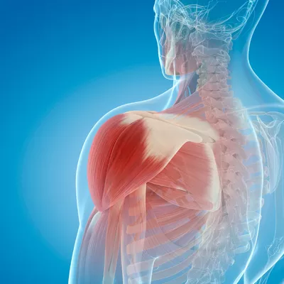 inflammation of the shoulder muscle