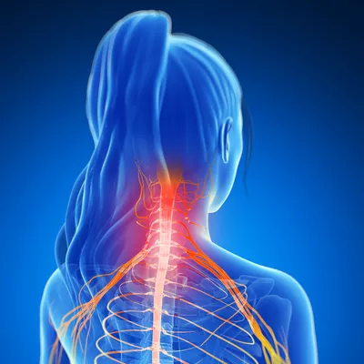 neck pain in women