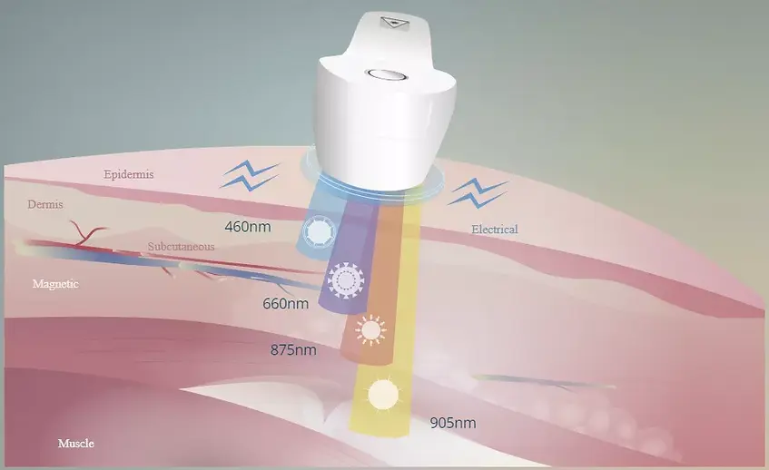 image for laser therapy