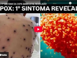 HAVERÁ PESTES (Mt 24, 7) - MPOX: 1º sintoma da cepa mais letal revelado