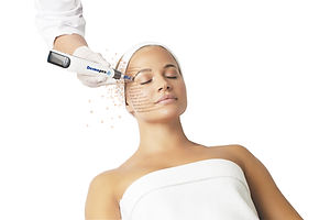 Dermapen4 with Nina.jpg