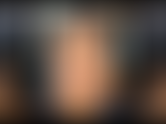 Case of Anterior Trauma Management