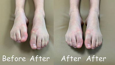 足・施術結果.zip - 3.png