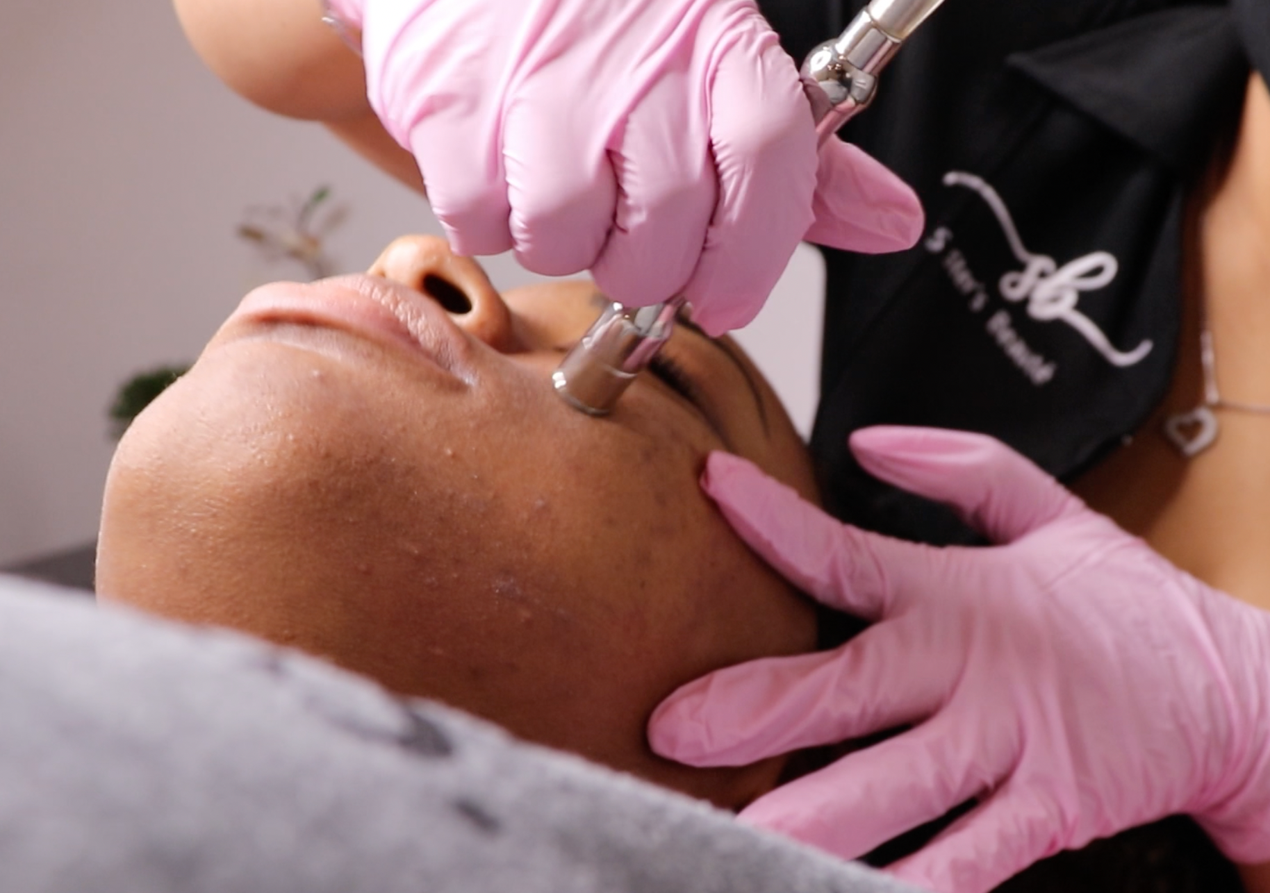 Formation Microdermabrasion