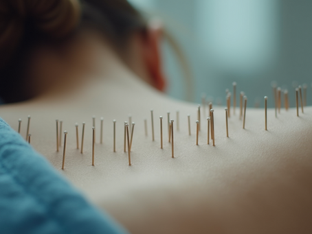 Unlock the Health Benefits of Acupuncture