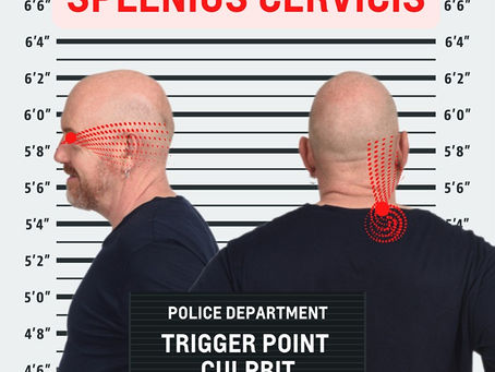 Splenius Cervicis. Whiplash Season Has Arrived.