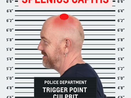 Put a Cap on Splenius Capitis Headaches!