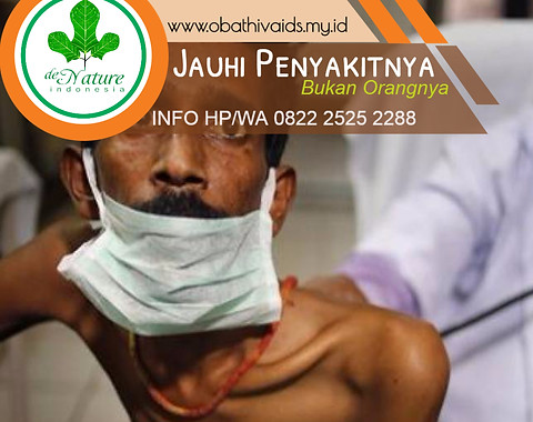 CARA MENGATASI HIV.jpeg
