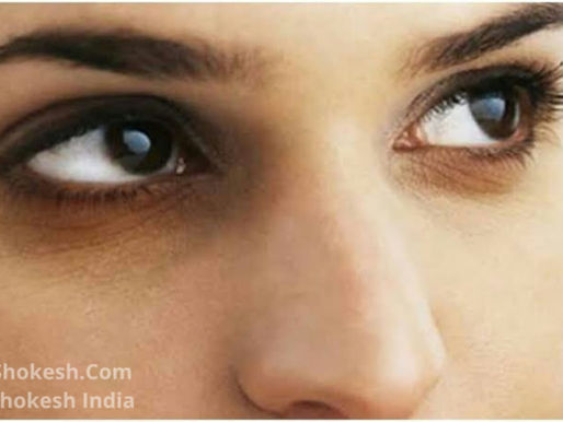 Get RID of DARK CIRCLES 😃💯