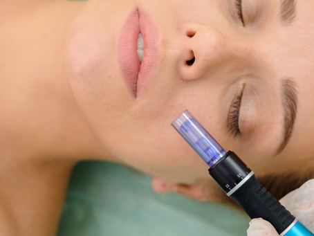 Micro-needling in Rugby, Art Form Aesthetics