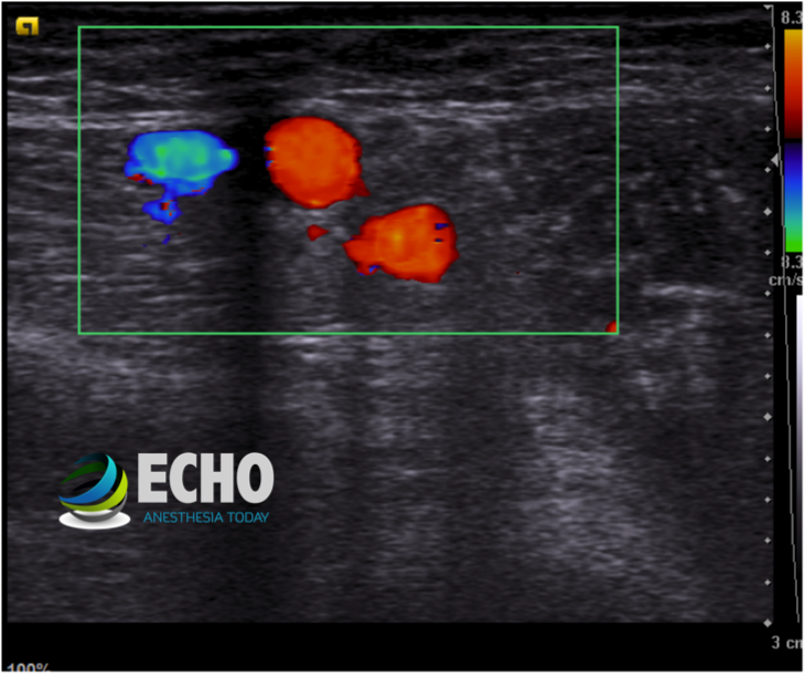 Double Axillary artery