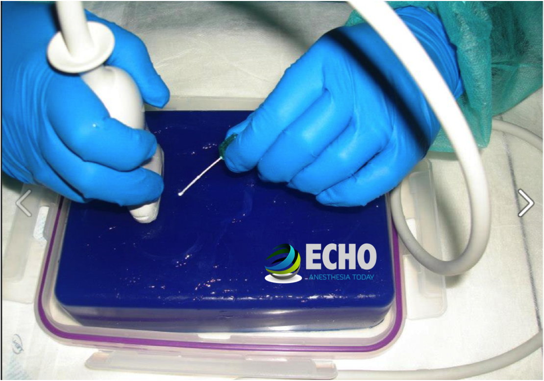 Phantom Needling