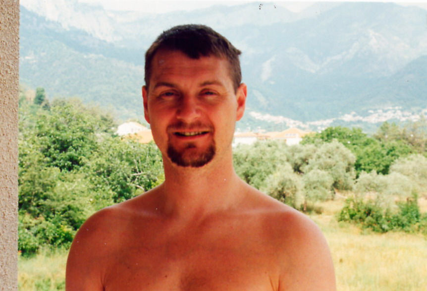 Patient with ualticaria after treatment with TCM