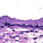 Células Citopatologia