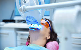 Teeth Whitening: In-Clinic vs. At-Home. What Really Works?