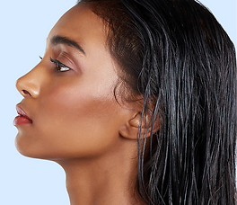 Kybella