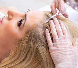 PRP Hair Restoration