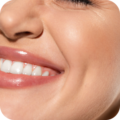 Smile Area