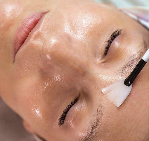 Reveal fresh, renewed skin with a professionally applied chemical peel.