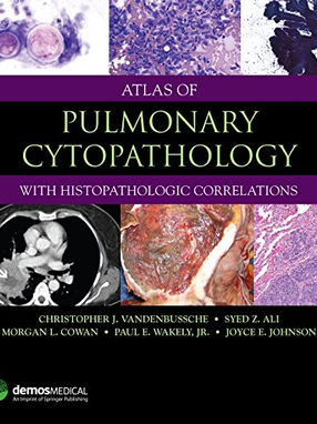 [2018] Atlas of Pulmonary Cytopathology