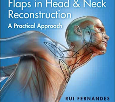 [2014] Local and Regional Flaps in Head and Neck Reconstruction: A Practical Approach 1st Edition