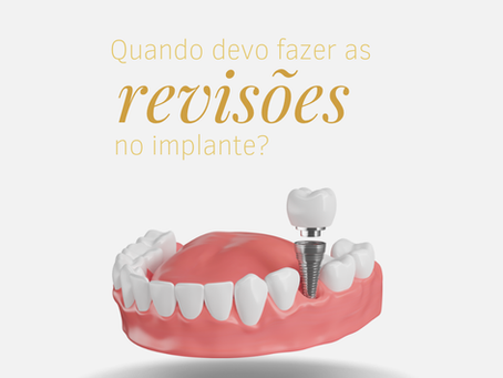 Quando Devo Fazer as Revisões no Implante Dentário?
