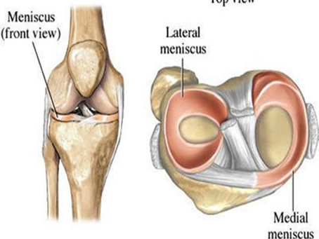 How Do Allied Health Experts at MD Health in Doncaster Assess Damage to the Menisci of the Knee?