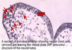 Early Development of the Nervous System | Home