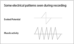 electrical_patterns.png