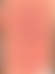 L'épisode de la CGTU