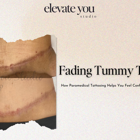 Fading Tummy Tuck Scars: How Paramedical Tattooing Helps You Feel Confident in Your Own Skin Again