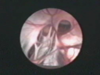 cap045.bmp