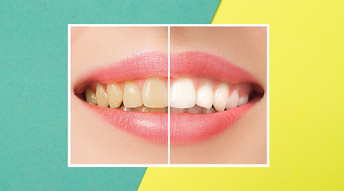 afterwhitening.png