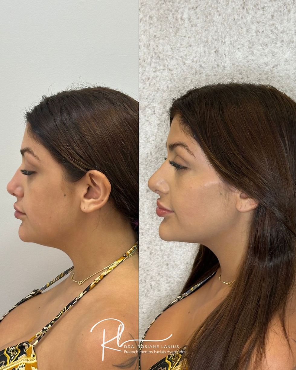 perfil