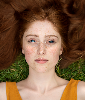freckles on a womans face
