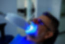 Zoom Teeth Whitening vs. Other Methods