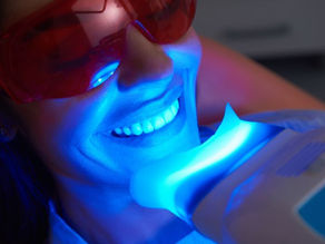 What Happens If You Over-Whiten Your Teeth? Risks Explained
