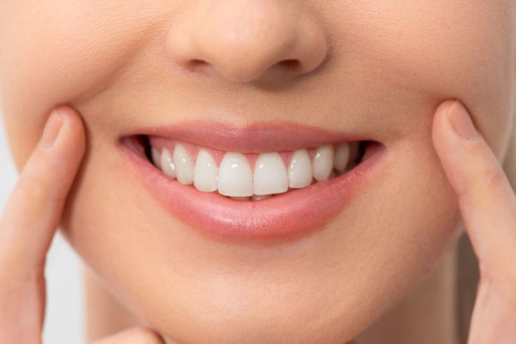Whitening Plus Cosmetic Options