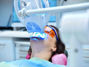 Is In-Chair Teeth Whitening Safe?
