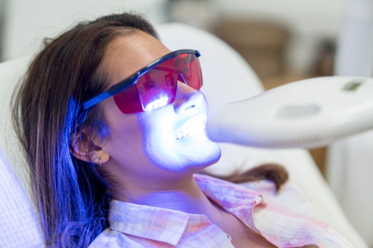 30-Minute In-Chair Whitening