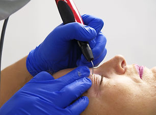 EYELID LIFT non surgical with Plasma, Plasmage or laser available at Brio Medical Cosmetic Clinic in St Kilda Rd, Melbourne